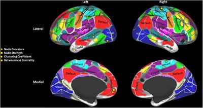 Robustness of Brain Structural Networks Is Affected in Cognitively Impaired MS Patients